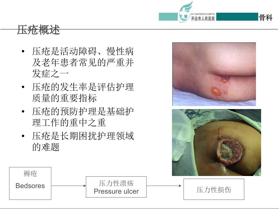 压疮最新分期护理，全面解析及实践策略指南